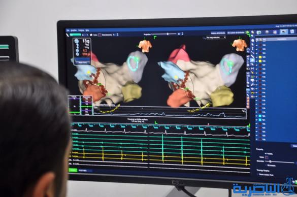 في تجربة اولى في العراق ،مركز الناصرية للقلب يجري عمليات ارتجاف الاذينين