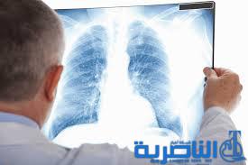 ذي قار تتعاقد مع طبيب بريطاني للعمل في المركز التخصصي بامراض الرئة