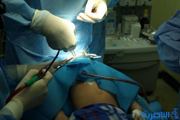 فريق طبي ايطالي يباشر باجراء مائة عملية جراحية تجميلية في الناصرية - تقرير مصور -