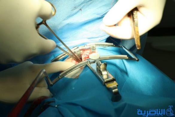فريق طبي ايطالي يباشر باجراء مائة عملية جراحية تجميلية في الناصرية - تقرير مصور -