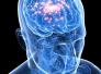 الصرع والتقدم العلمي  The epilepsy and scientific development/د. مسار مسلم صالح الغرابي
