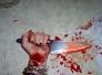 نجاة فتاتين من الموت انتحارا في حادثين منفصلين في الناصرية والنصر نجاة فتاتين من الموت انتحارا في حادثين منفصلين في الناصرية والنصر